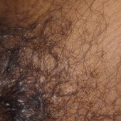 BITHI(*):##