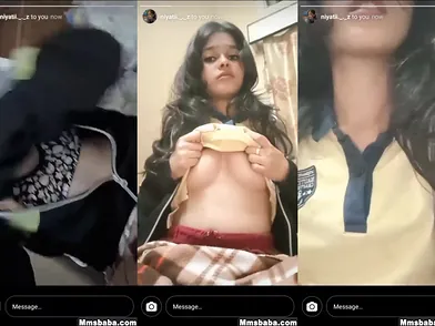 Insane Nymph Flashes Her Congenital Bumpers To